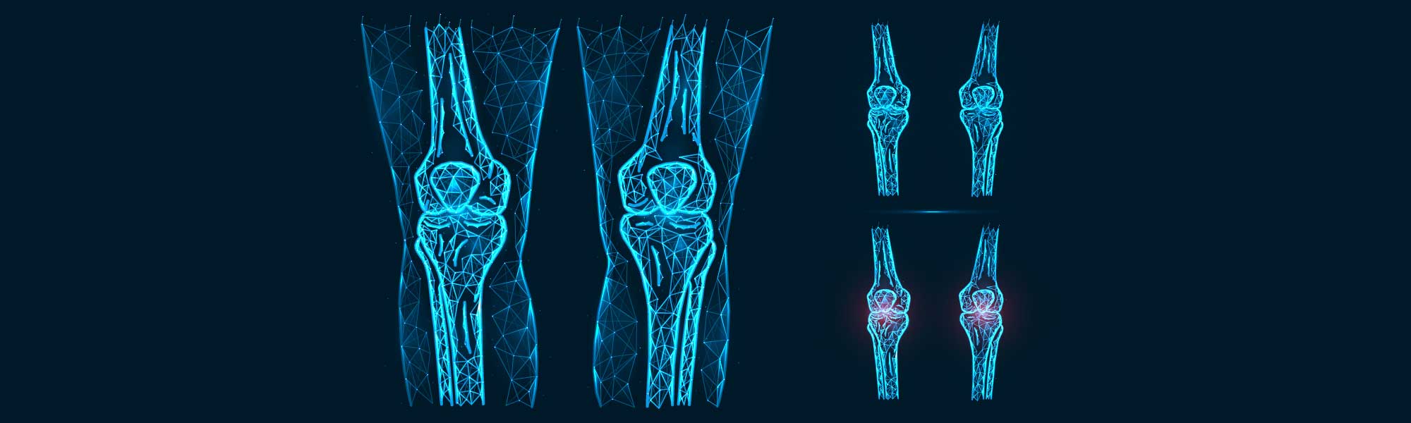 Abstract polygonal illustration of human knee anatomy. Disease, pain and inflammation of the knee joints isolated on blue background.