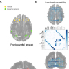 The Neurobiological Foundations of Musicality