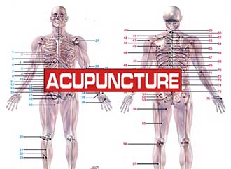 acupuncture