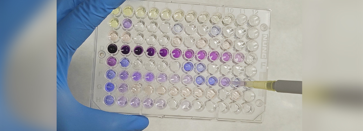 FABXS - Development of a diagnostic kit for the quantification of serum ...