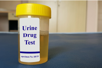 Sample of urine